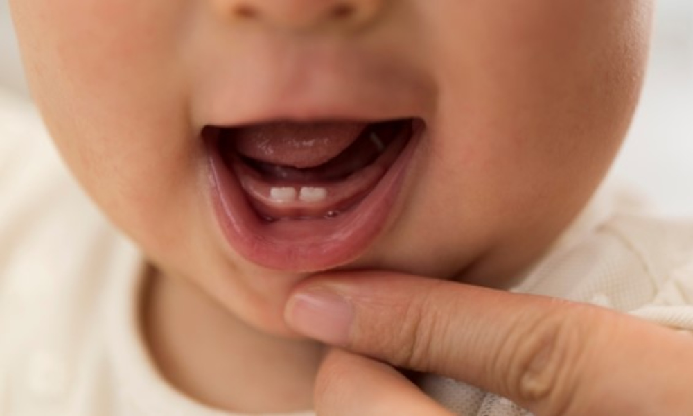 pacifiers and baby teeth: impact and considerations